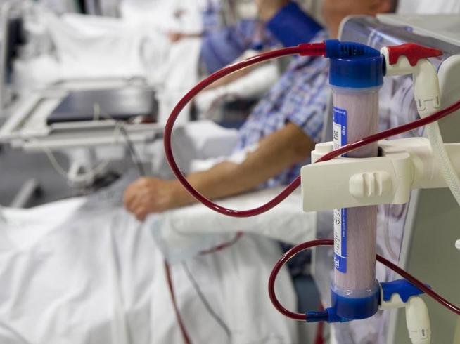 Sacubitrilovalsartán En Pacientes Con Insuficiencia Cardíaca Y Enfermedad Renal Terminal Medecs 6594